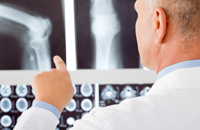 Matičnim ćelijama će se liječiti teži prelomi Matičnim ćelijama će se liječiti teži prelomi