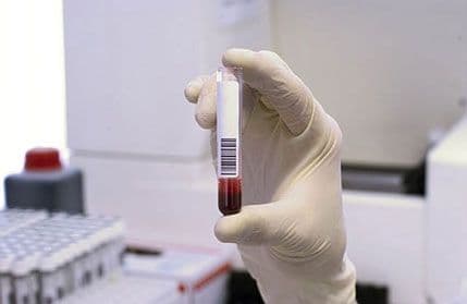 Uskoro štampani 3D organi Uskoro štampani 3D organi