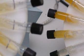 Komisija za antidoping sprovela doping kontrole crnogorskih sportista pred Paraolimpijske igre, svi uspješno prošli testove Komisija za antidoping sprovela doping kontrole crnogorskih sportista pred Paraolimpijske igre, svi uspješno prošli testove