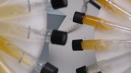 Doping afera trese Australiju Doping afera trese Australiju