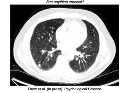 Da li vidite gorilu? Radiolozi nijesu Da li vidite gorilu? Radiolozi nijesu