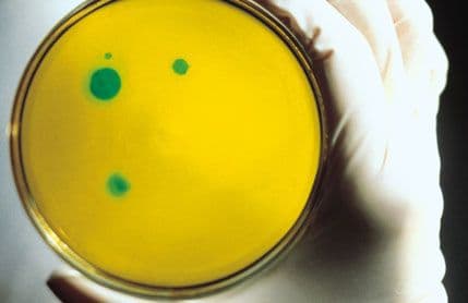 Kad antibiotici ne ubijaju bakterije... Kad antibiotici ne ubijaju bakterije...