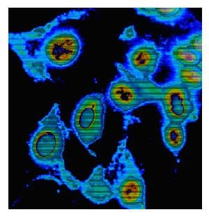U Bijelom Polju i Žabljaku registrovana Q-groznica U Bijelom Polju i Žabljaku registrovana Q-groznica
