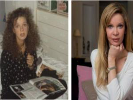 Bivša engleska manekenka uradila 330 estetskih operacija Bivša engleska manekenka uradila 330 estetskih operacija