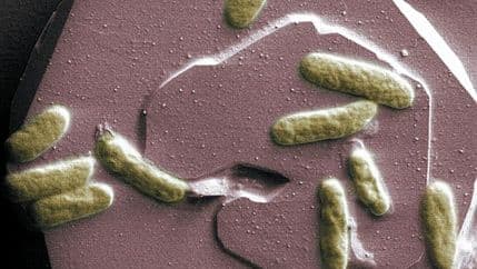 VIDEO: Bakterije od otpada proizvode struju VIDEO: Bakterije od otpada proizvode struju