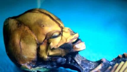 “Vanzemaljac iz Atakame” je – genetska mutacija čovjeka? “Vanzemaljac iz Atakame” je – genetska mutacija čovjeka?