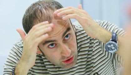 „Vampirski" lijek protiv ćelavosti „Vampirski" lijek protiv ćelavosti