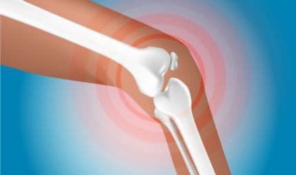 Mutacije gena utiču na osteoporozu? Mutacije gena utiču na osteoporozu?