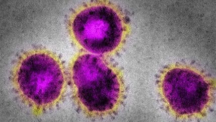 Da li je smrtonosni virus NCoV novi SARS? Da li je smrtonosni virus NCoV novi SARS?