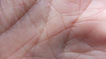 Zašto imamo linije na dlanovima? Zašto imamo linije na dlanovima?