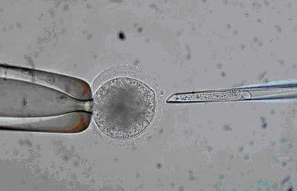 Britanci odobrili rađanje djece sa korigovanom DNK Britanci odobrili rađanje djece sa korigovanom DNK