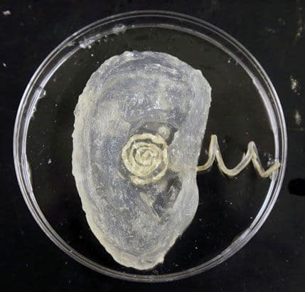 Konstruisano prvo živo vještačko uvo (VIDEO) Konstruisano prvo živo vještačko uvo (VIDEO)