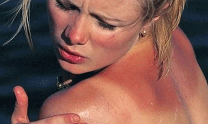 Šta kada koža izgori na suncu: Šest korisnih savjeta Šta kada koža izgori na suncu: Šest korisnih savjeta