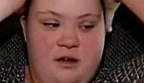 Naučnici uspjeli da „isključe“ hromozom koji izaziva Daunov sindrom! Naučnici uspjeli da „isključe“ hromozom koji izaziva Daunov sindrom!