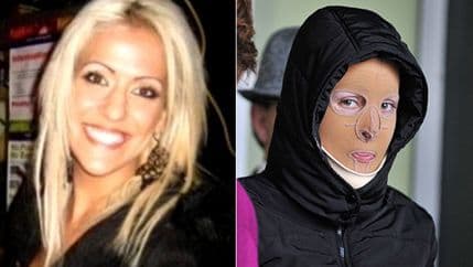 Australija: Makedonka proglašena krivom jer je zapalila sunarodnicu Australija: Makedonka proglašena krivom jer je zapalila sunarodnicu