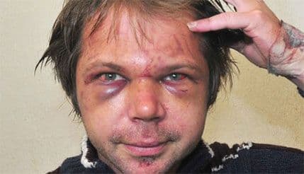 Nastavnika iz Novog Sada pretukla grupa osnovaca  Nastavnika iz Novog Sada pretukla grupa osnovaca