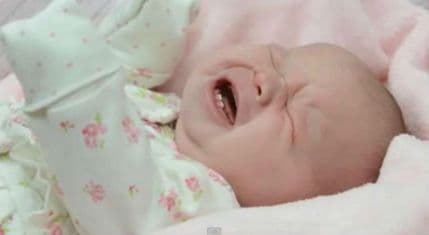 Rođena beba sa dva prednja zuba Rođena beba sa dva prednja zuba