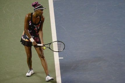 VIDEO: Najbrži servis u istoriji ženskog tenisa VIDEO: Najbrži servis u istoriji ženskog tenisa