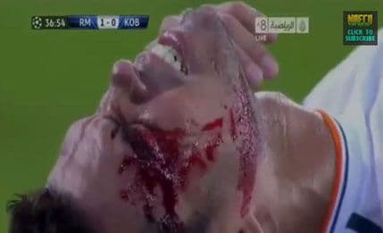 VIDEO: Pepeu razbili glavu VIDEO: Pepeu razbili glavu