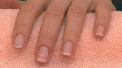 Vaši nokti mogu biti odraz zdravlja Vaši nokti mogu biti odraz zdravlja