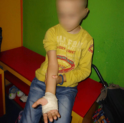 Bar: Dječaku pas razderao ruku, u ambulanti tražili da dovedu psa! Bar: Dječaku pas razderao ruku, u ambulanti tražili da dovedu psa!