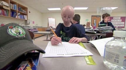 Potresna priča o dječaku koji se bori sa ubrzanim starenjem Potresna priča o dječaku koji se bori sa ubrzanim starenjem