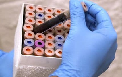 Naučnici upozoravaju: Otpornost na antibiotike najveća prijetnja u istoriji medicine Naučnici upozoravaju: Otpornost na antibiotike najveća prijetnja u istoriji medicine