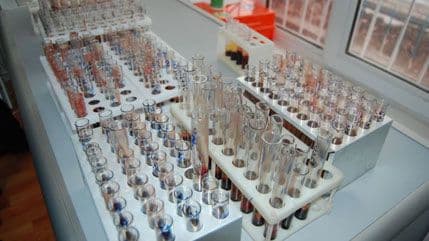 Medicinari osuđuju oboljele od side Medicinari osuđuju oboljele od side