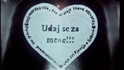 Domišljati Mostarac zaprosio curu – preko rendgena Domišljati Mostarac zaprosio curu – preko rendgena