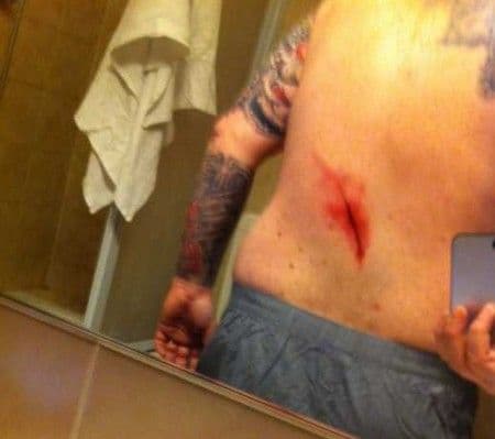 Navijači Kopenhagena izbodeni u Torinu Navijači Kopenhagena izbodeni u Torinu