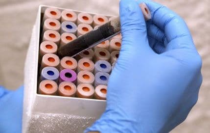 Rano otkrivanje raka putem analize krvi? Rano otkrivanje raka putem analize krvi?