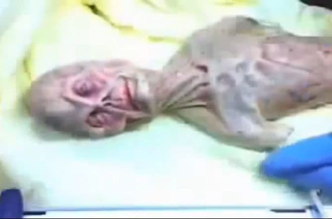 Glas Rusije: Da li su Rusi radili autopsije na vanzemaljcima?  Glas Rusije: Da li su Rusi radili autopsije na vanzemaljcima?