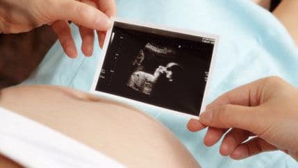 Ginekolozi s oprezom tumače statistiku pola novorođenčadi: Broj abortusa manji nego ikad Ginekolozi s oprezom tumače statistiku pola novorođenčadi: Broj abortusa manji nego ikad