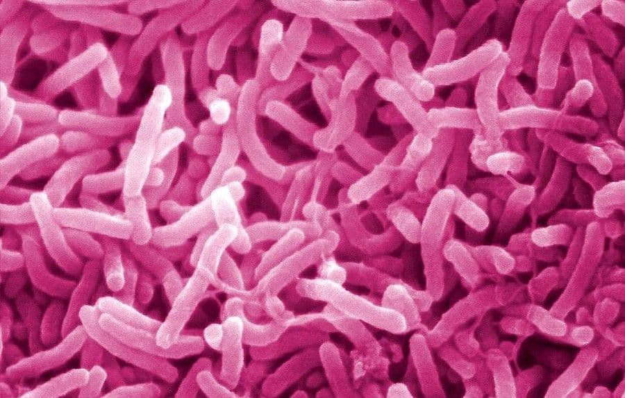 Otkriveno porijeklo bakterije kolere Otkriveno porijeklo bakterije kolere