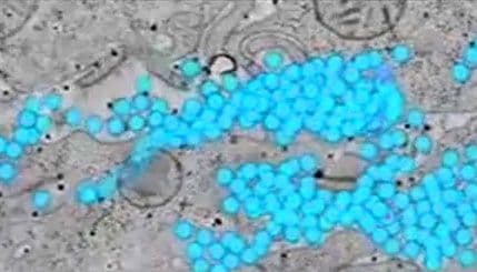 VIDEO: Prvi snimak napada HIV-a na zdrave ćelije VIDEO: Prvi snimak napada HIV-a na zdrave ćelije