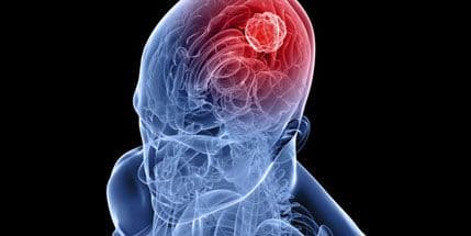 Nova metoda uništavanja tumora: Rak postaje bolest s kojom se može živjeti! Nova metoda uništavanja tumora: Rak postaje bolest s kojom se može živjeti!