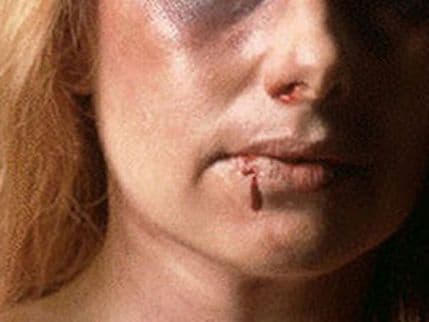 Trećina žena u EU pretrpjela fizičko i seksualno nasilje Trećina žena u EU pretrpjela fizičko i seksualno nasilje