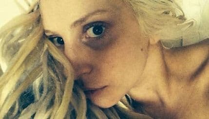 Lejdi Gaga uplašila obožavatelje Lejdi Gaga uplašila obožavatelje