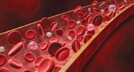 Dvanaest znakova da možda imate nedostatak gvožđa Dvanaest znakova da možda imate nedostatak gvožđa