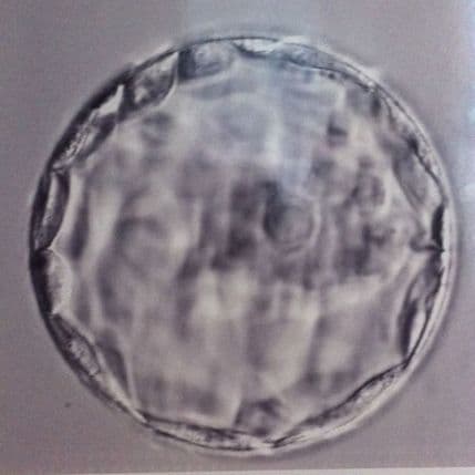 Kloniranjem ljudskih ćelija do novih terapija Kloniranjem ljudskih ćelija do novih terapija