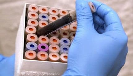 Naučnici našli lijek protiv bola bez neželjenih dejstava Naučnici našli lijek protiv bola bez neželjenih dejstava