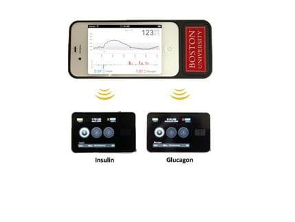 Naučnici razvili "vještački pankreas" koji obećava Naučnici razvili "vještački pankreas" koji obećava