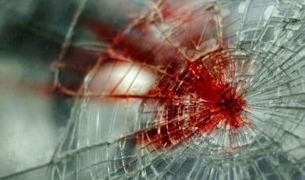 Austrijska državljanka poginula na putu Podgorica - NIkšić Austrijska državljanka poginula na putu Podgorica - NIkšić