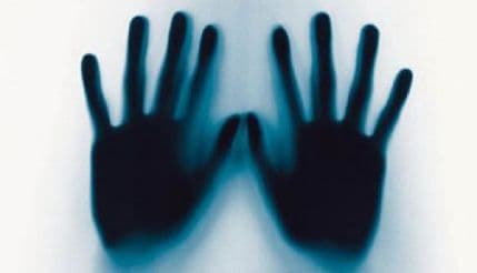 Muškarci najčešće žrtve prisilnog rada, žene seksualne eksplotacije Muškarci najčešće žrtve prisilnog rada, žene seksualne eksplotacije