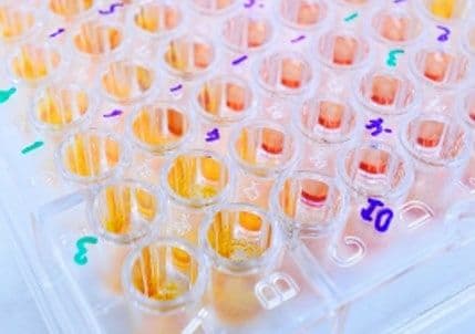 Da li ćemo uskoro moći da usporimo starenje? Da li ćemo uskoro moći da usporimo starenje?