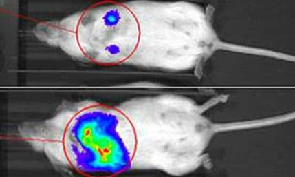 Otkriven način da se zaustavi metastaziranje raka dojke Otkriven način da se zaustavi metastaziranje raka dojke