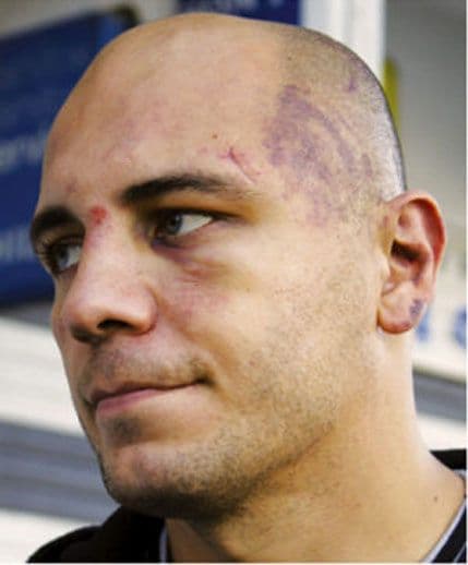 Policajci osuđeni za prebijanje Pejanovića vraćeni na posao Policajci osuđeni za prebijanje Pejanovića vraćeni na posao