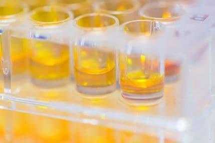 Naučnici stvorili matične ćelije koje ubijaju rak Naučnici stvorili matične ćelije koje ubijaju rak