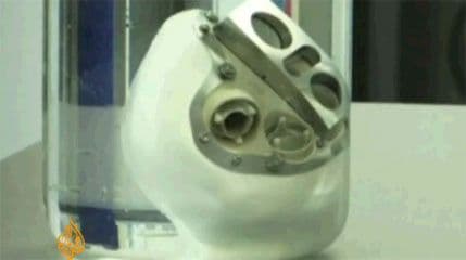 Pacijent s vještačkim srcem osjeća se odlično Pacijent s vještačkim srcem osjeća se odlično