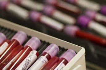 Uvećane kazne za doping